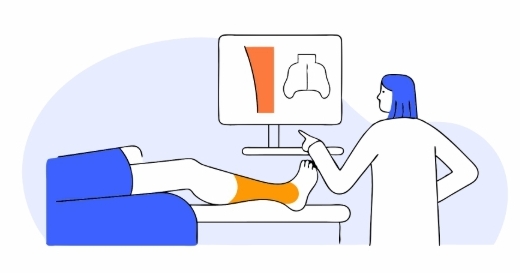 족저근막염 수술 과정