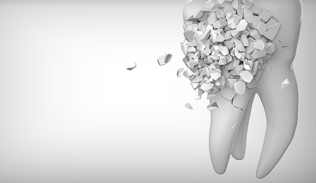 치아보험 면책기간