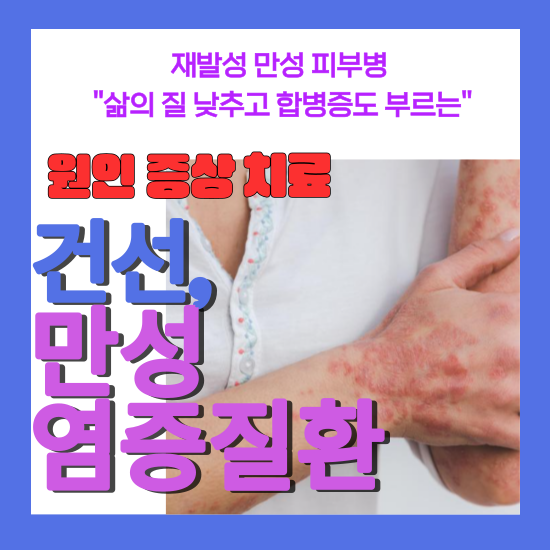 건선, 평생을 함께하는 만성 염증 질환
