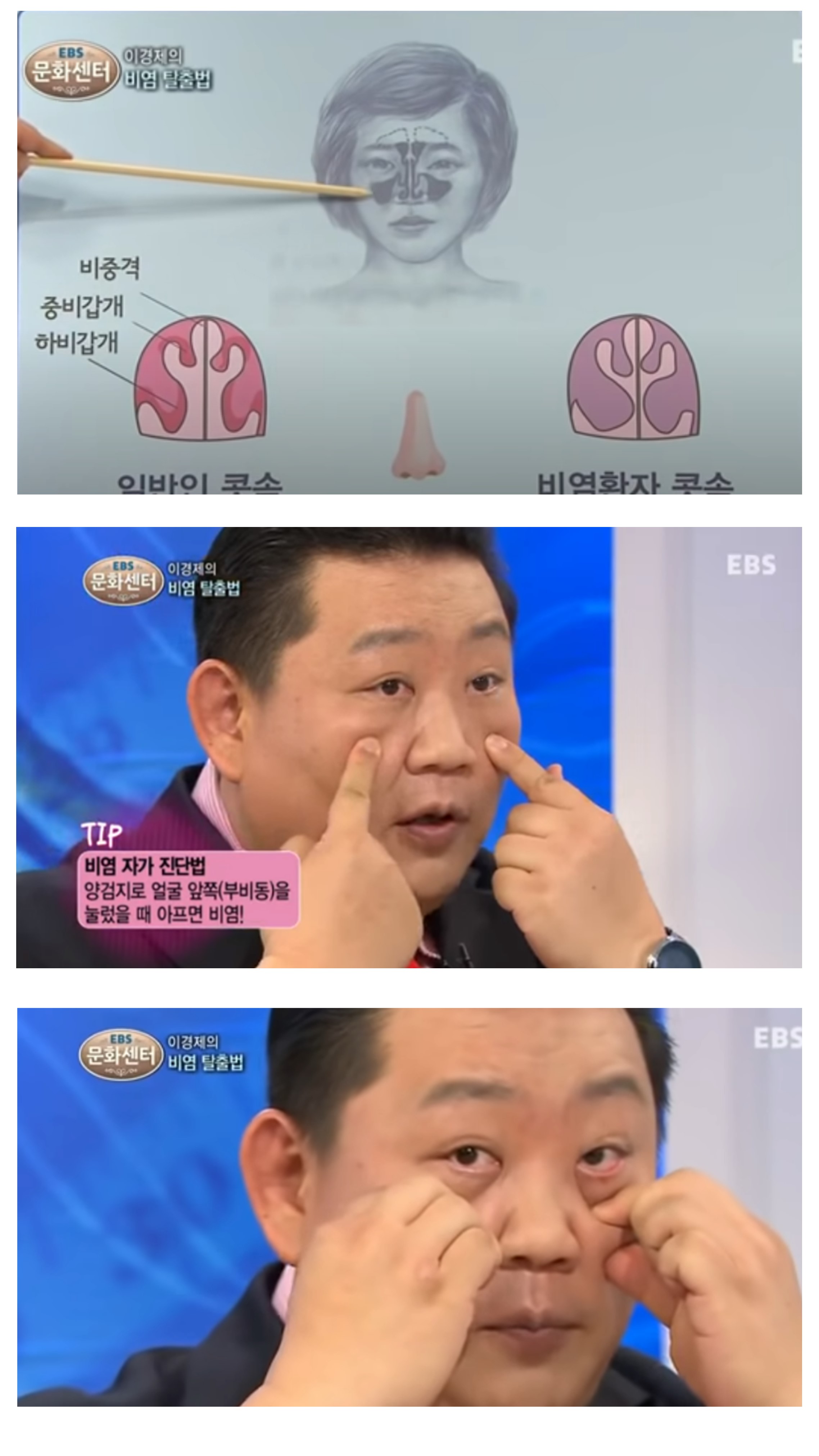 이경제원장의-비염-탈출방법