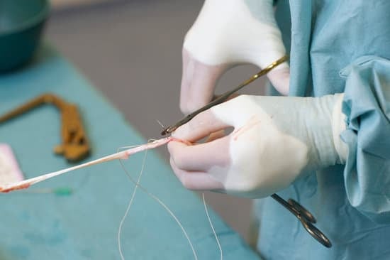 전방 십자 인대 수술