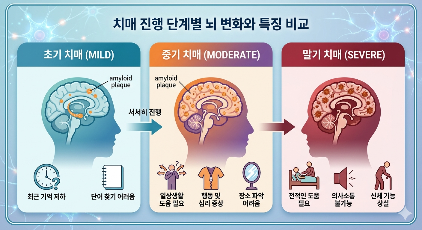 치매 단계별 주요 특징 총정리