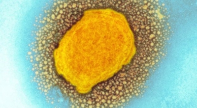 원숭이두창 이미지