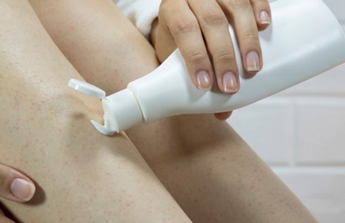 모공각화증 로션 미스트 추천 