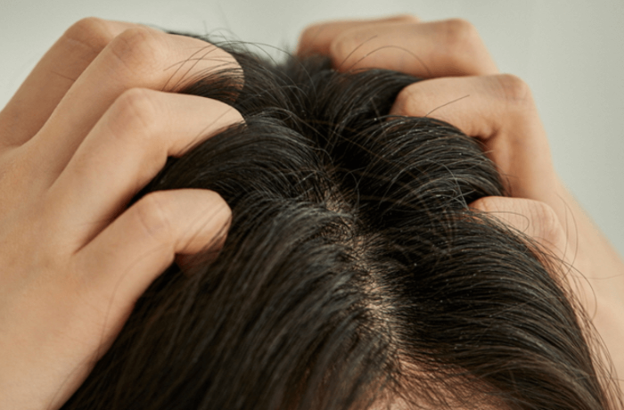 지성 머리카락 고민 해결! 효과적인 관리 방법