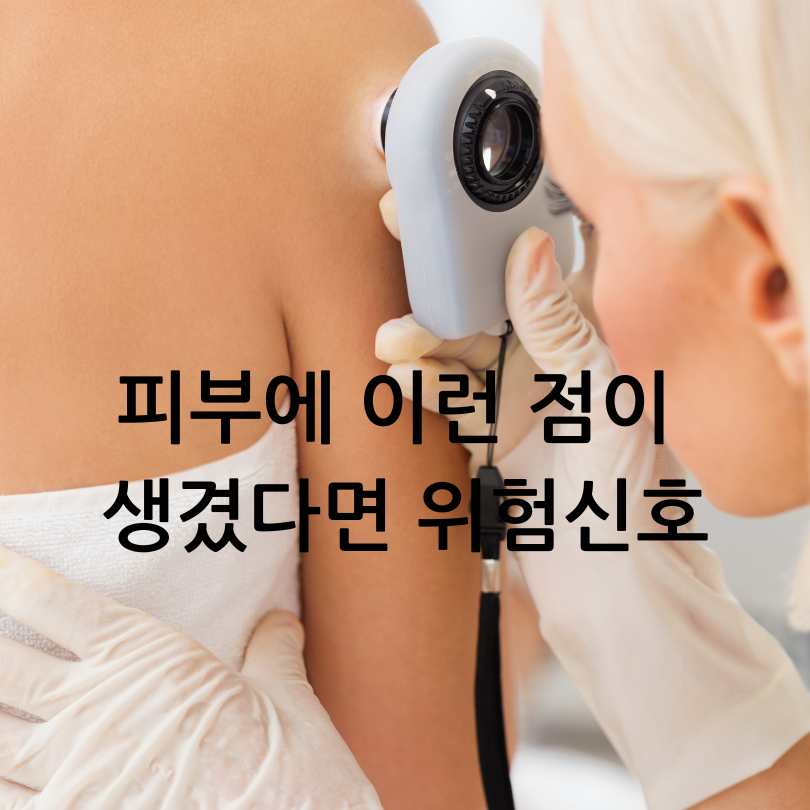 피부암 자가진단법, 피부암 점모양과 초기증상