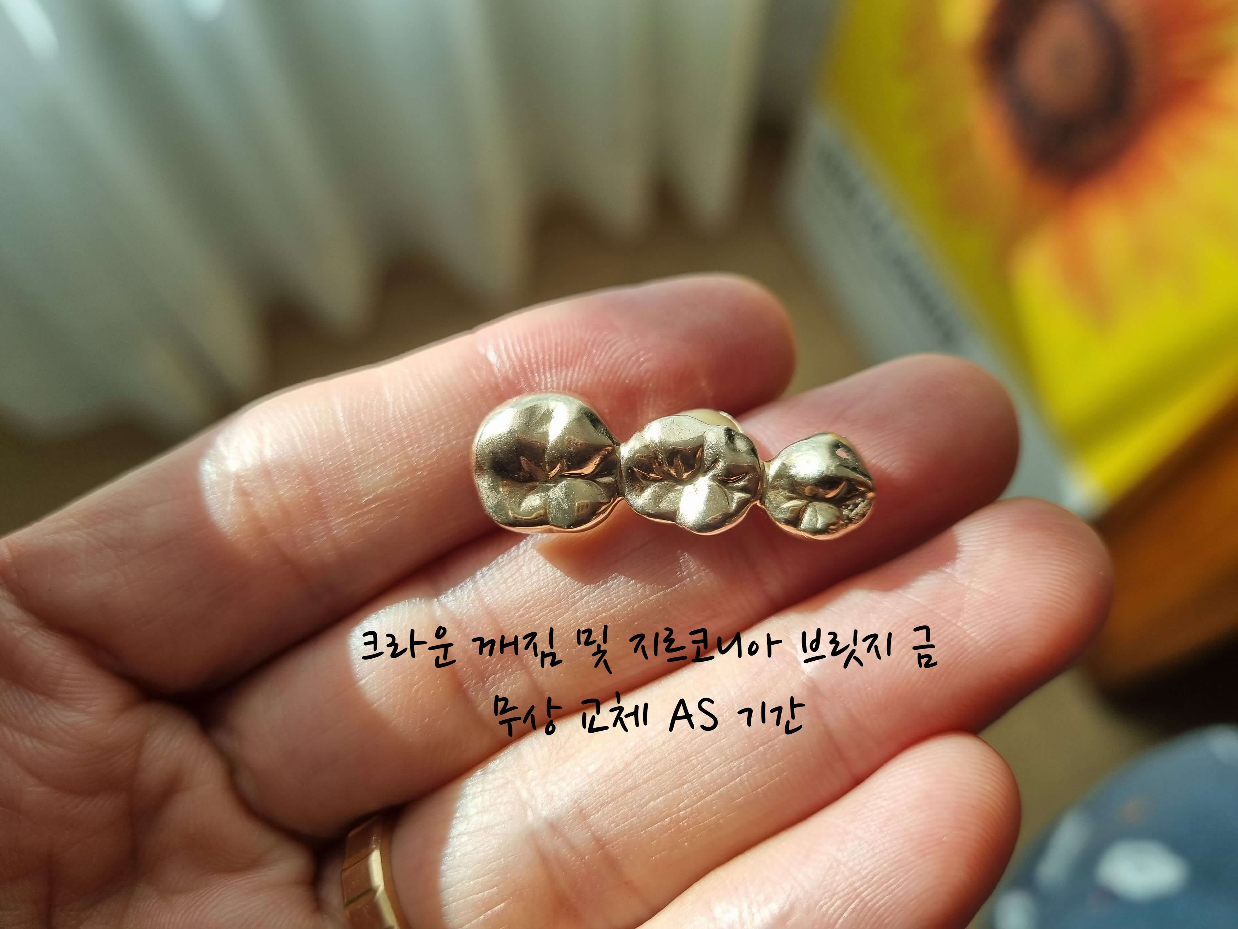 크라운 꺠짐