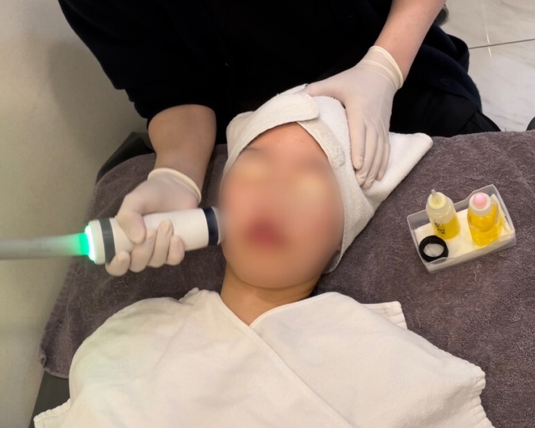 온다 리프팅 후기