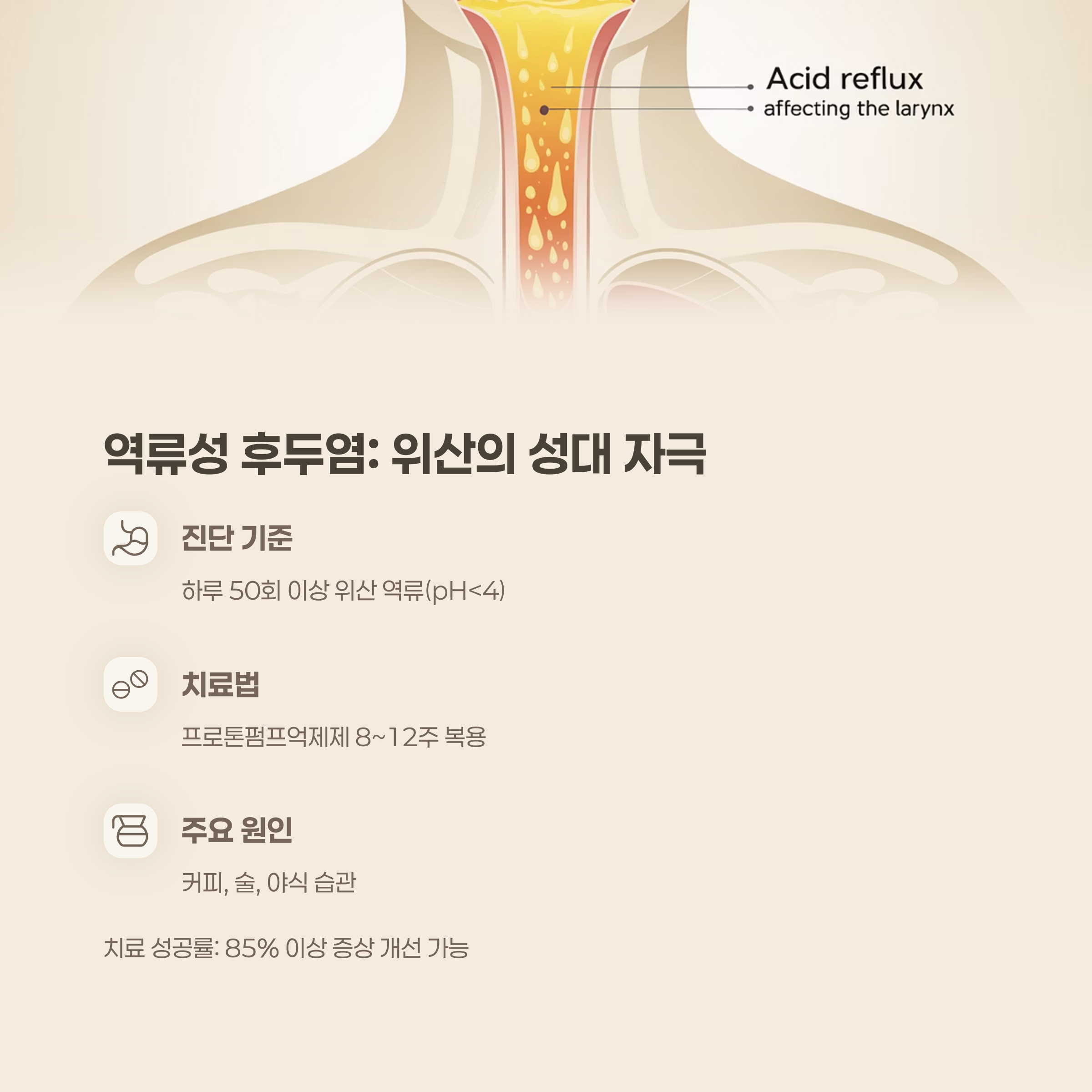 역류성 후두염: 위산이 성대를 자극