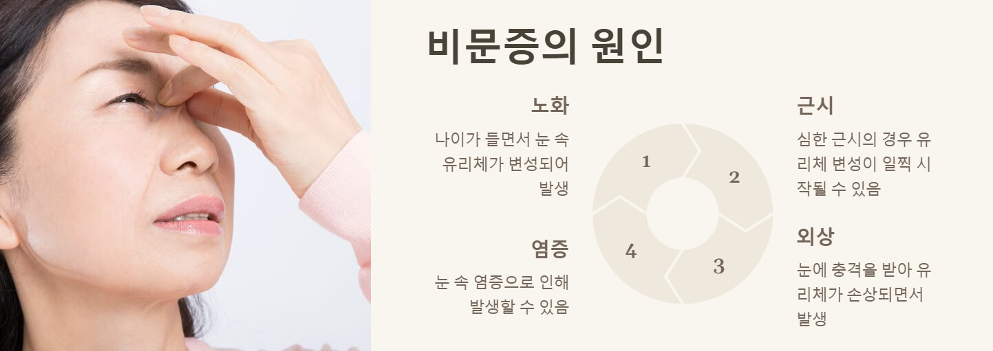 비문증 원인 자연치유 치료방법