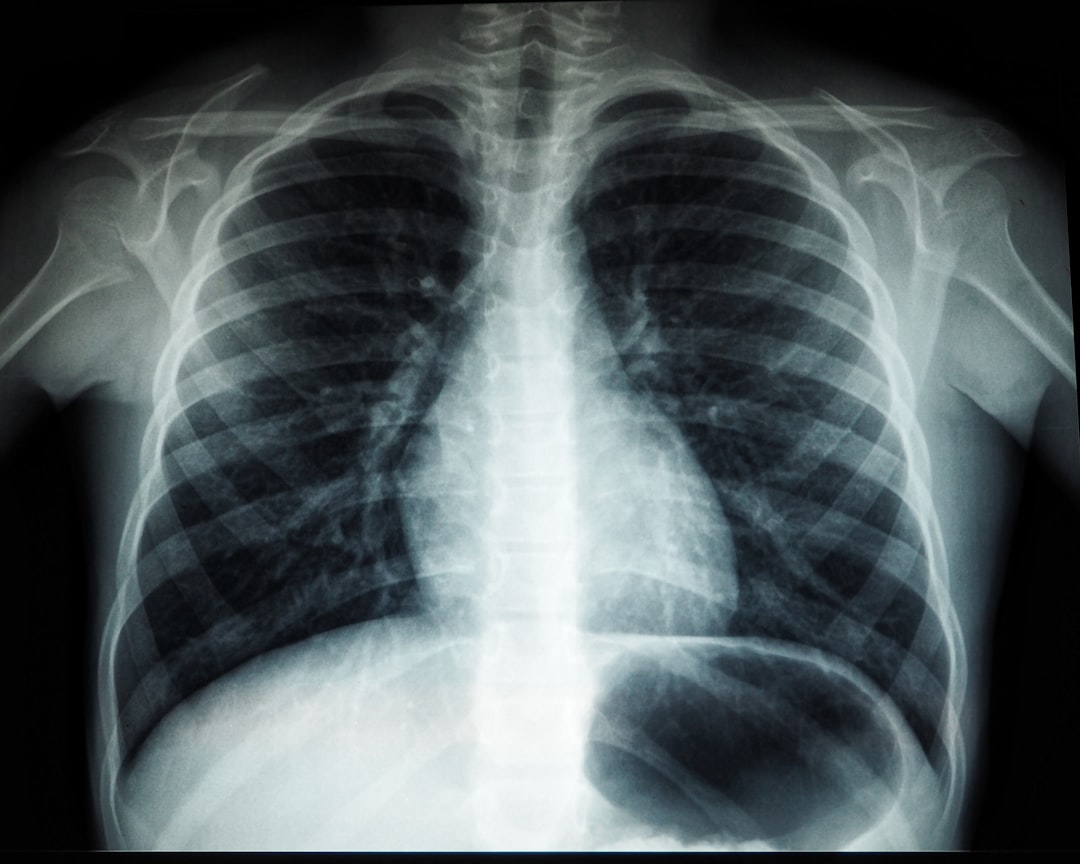 'X-ray'