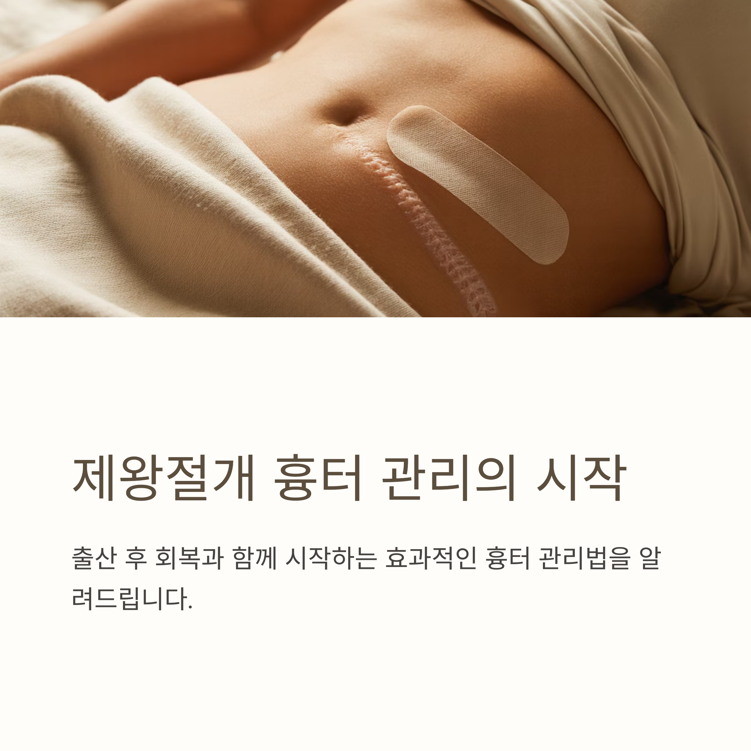 제왕절개 수술 후 복부에 흉터가 남아 있는 모습과 반창고를 붙인 여성의 복부 클로즈업 이미지