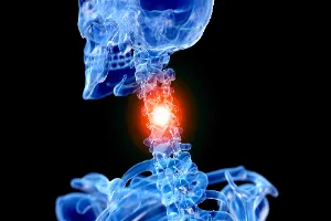 목디스크-시술비용