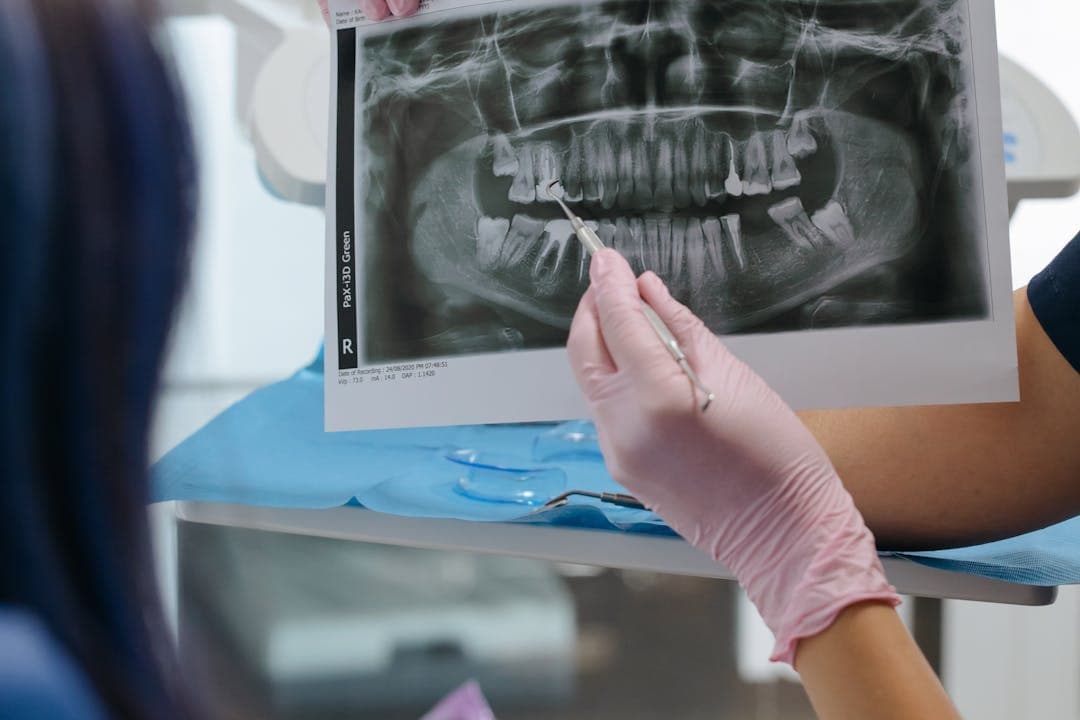 임플란트 진단용 파노라마 엑스레이 판독 장면