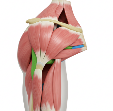회전근개파열 증상 및 치료법3