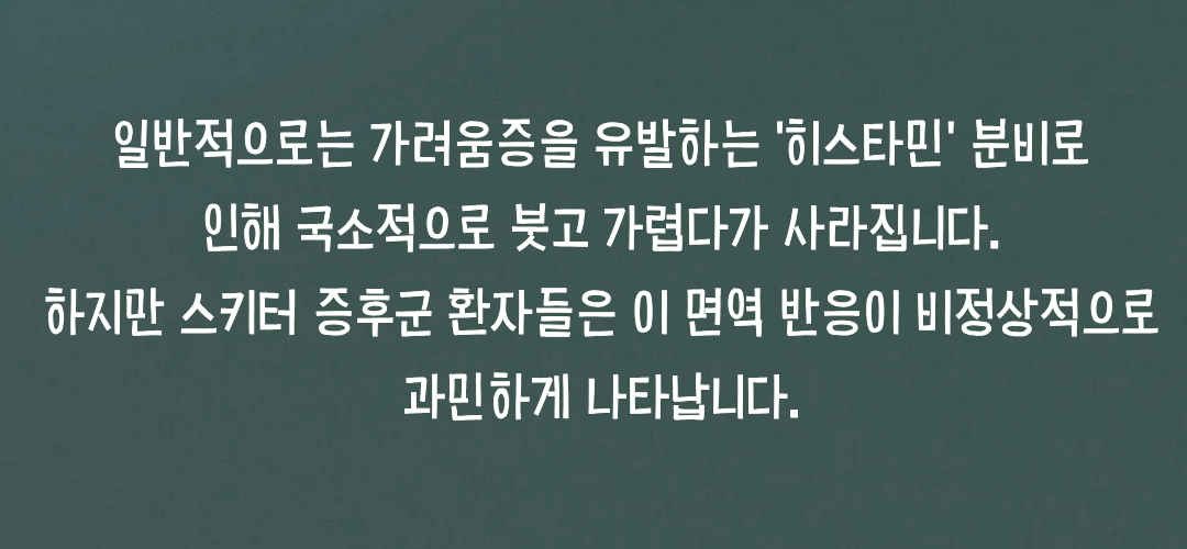 일반 모기 물림과 어떻게 다른가요?