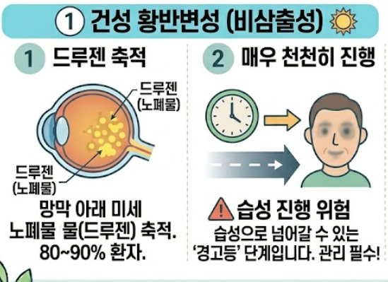 황반변성 증상