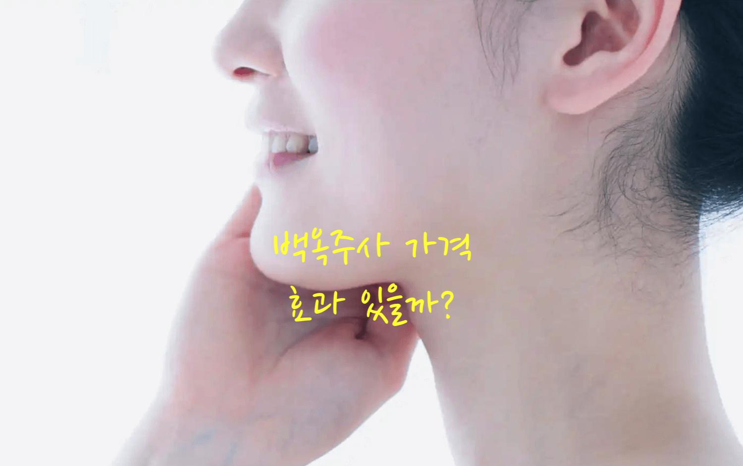 백옥주사 가격