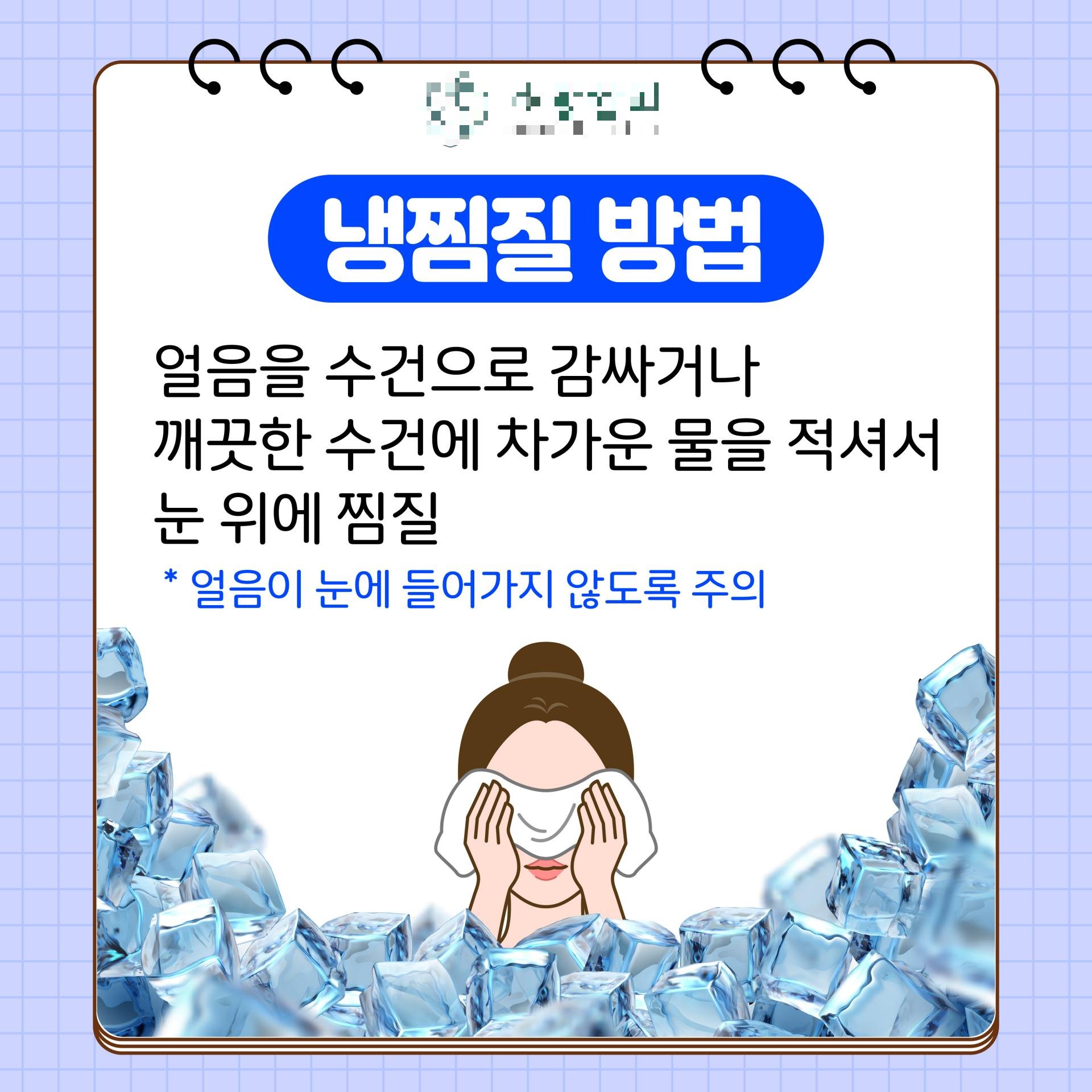 눈 온찜질기 추천 대상 콘택트렌즈 안구건조증 직장인