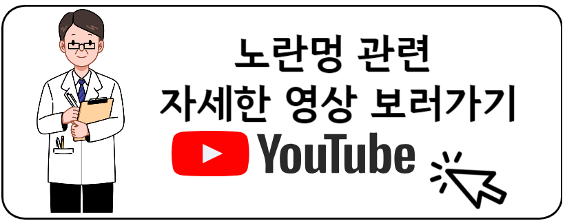 노란멍