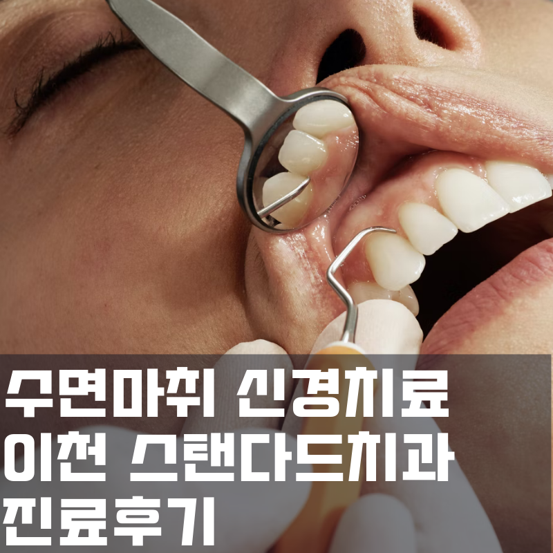 수면마취 신경치료 후기