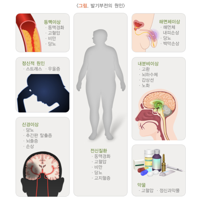 발기부전 원인