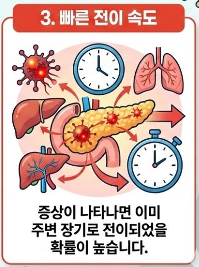 췌장암 검사방법