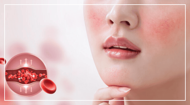 술 마시면 얼굴이 붉어지는 이유