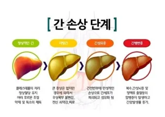 비알콜성 지방간 없애는 방법 운동 식단 중심 회복법 정리_12