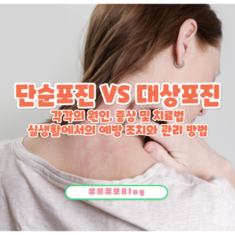 단순포진과 대상포진의 차이점