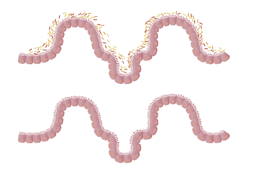 폴로라 장내 세균 장의 관