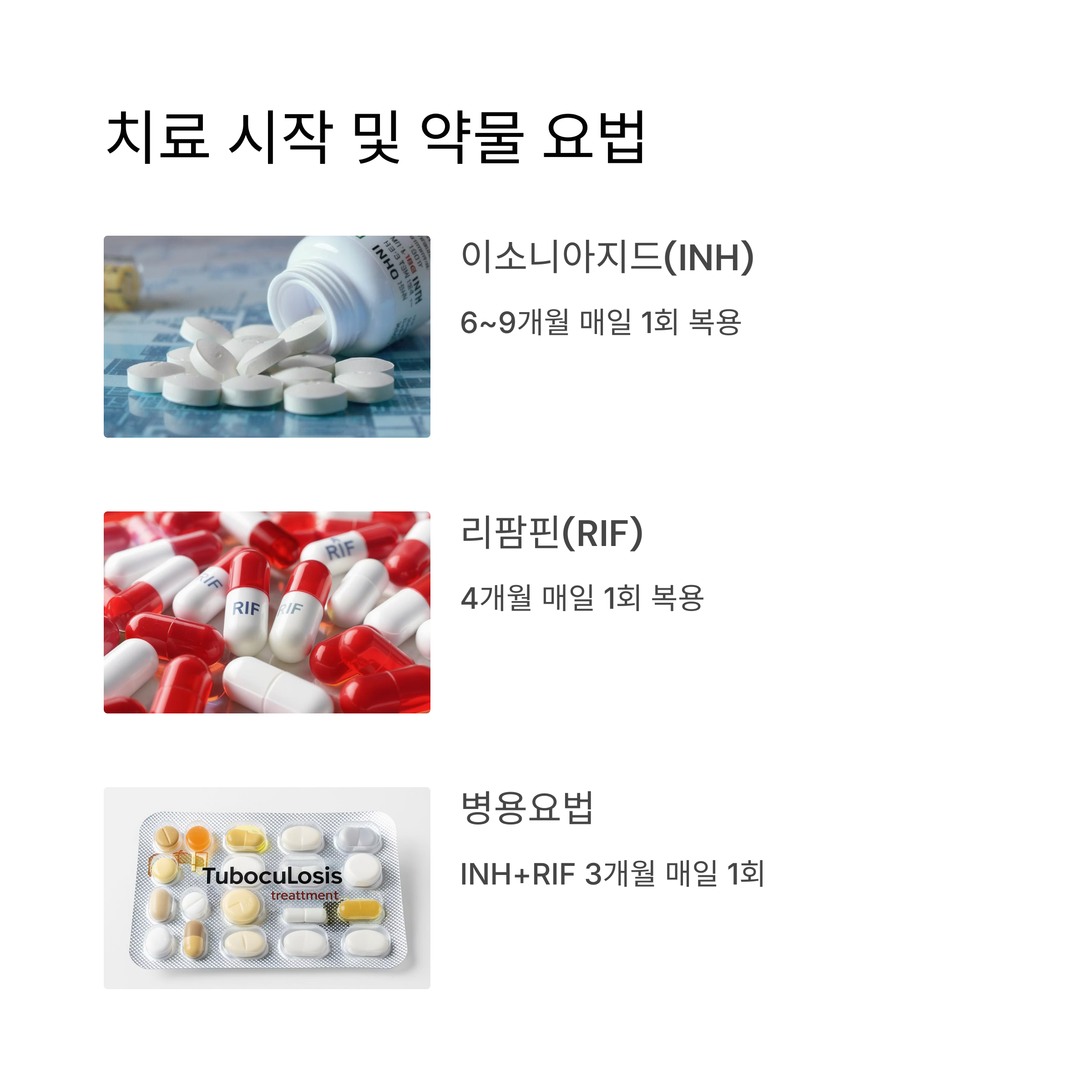 치료 시작 및 약물