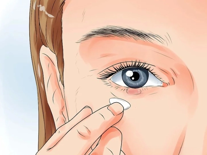 다래끼 원인 종류 빨리낫는법 눈다래끼 초기증상 치료 전염 찜질