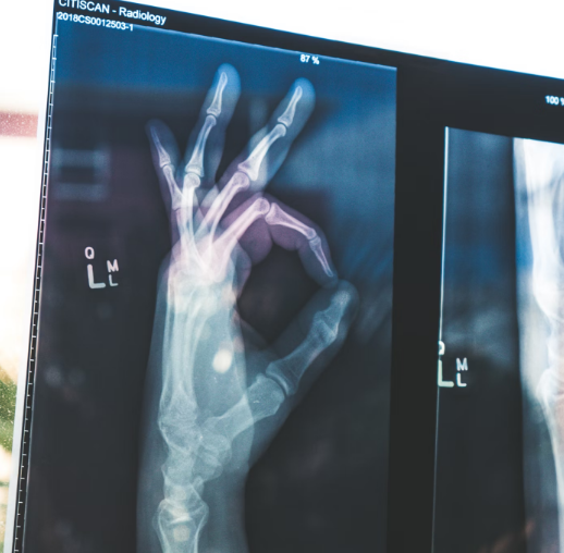 손가락 저림 원인찾기2