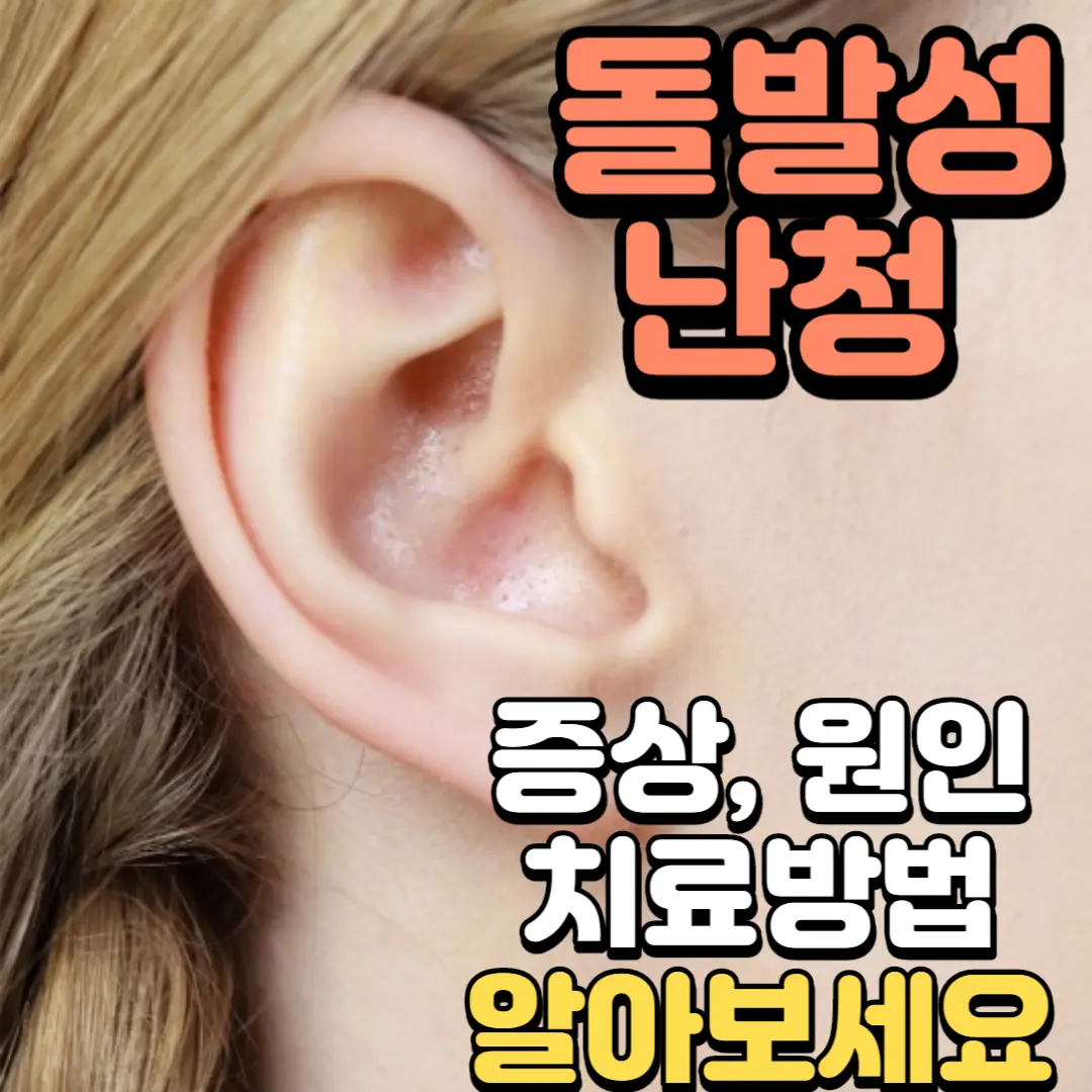 돌발성 난청 증상&#44;원인 치료방법 알아보세요