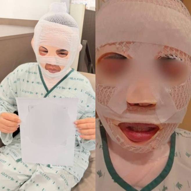 태국인 아내에 대한 폭력 사건 ❘ 끓는 물 화상 ❘ 남편 누구?