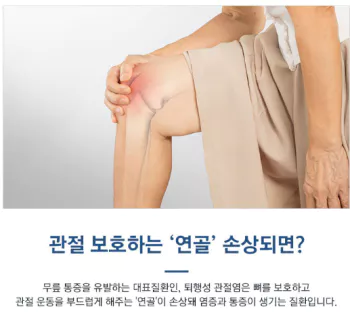 무릎연골-사진