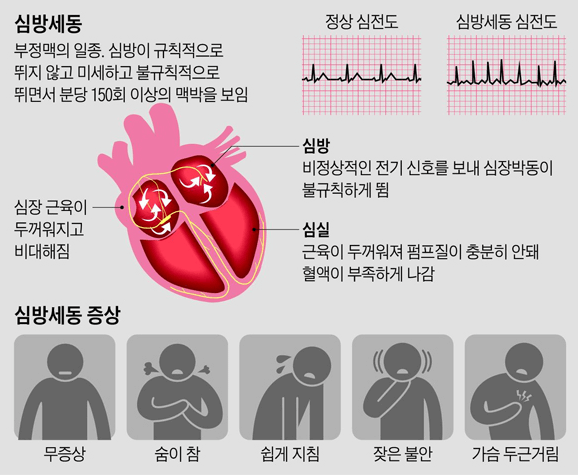 심상세동 증상
