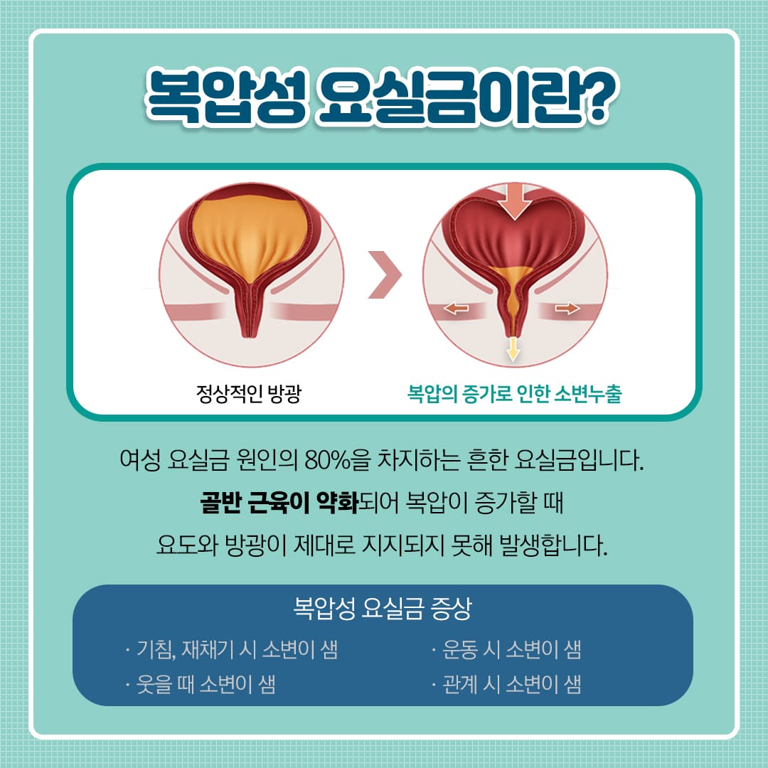 복압성 요실금이란?