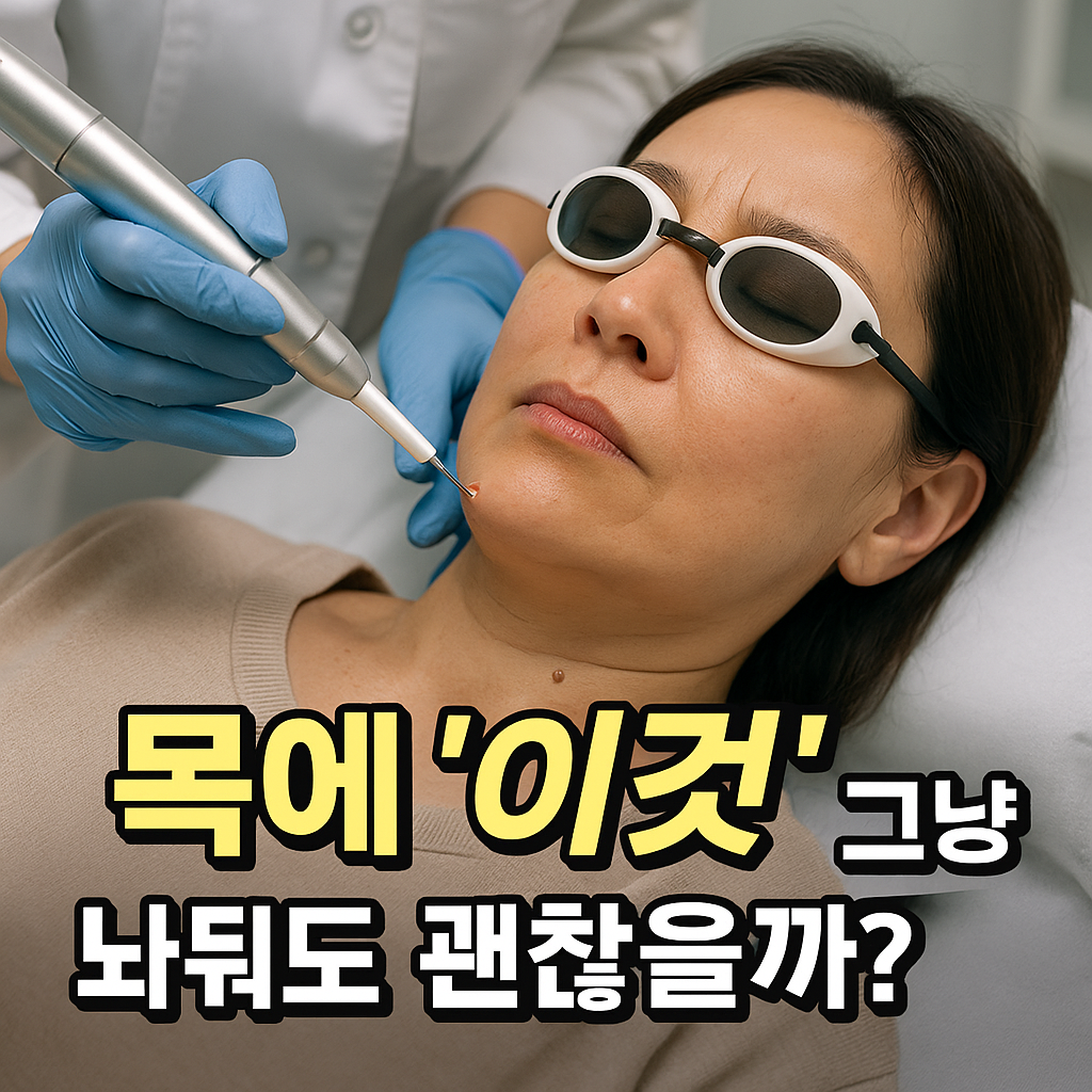 목에 쥐젖 왜 생기나 원인부터 제거 방법까지 완벽 정리