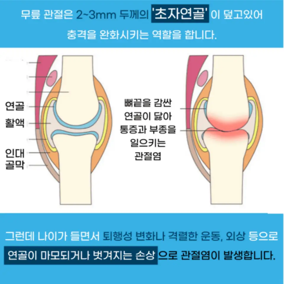 프로테오글리칸 효능 가격 추천