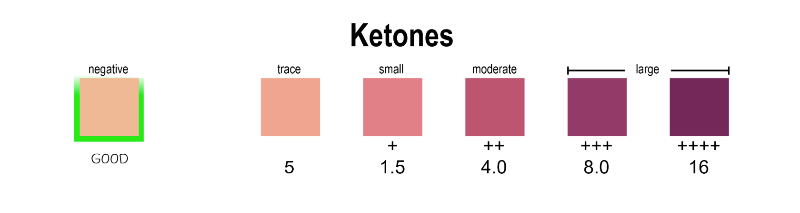 뇨스팅의 케톤 색상 가이드표