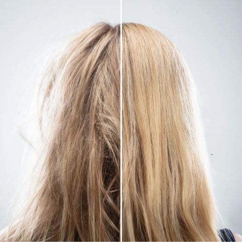 양모모발증후군 관리법 세럼 오일사용