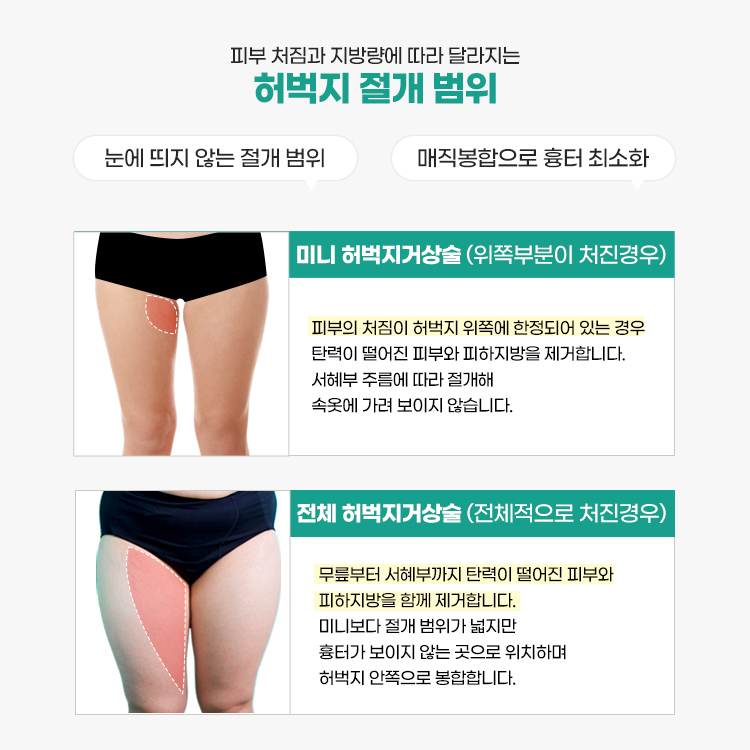 허벅지 리프팅은 과도한 피부와 경우에 따라 지방을 제거하여 허벅지의 윤곽과 외관을 개선하는 것을 목표로 하는 수술 절차입니다. 허벅지 리프팅에는 다양한 유형이 있으며 선택은 환자의 특정 관심사와 목표에 따라 다릅니다.