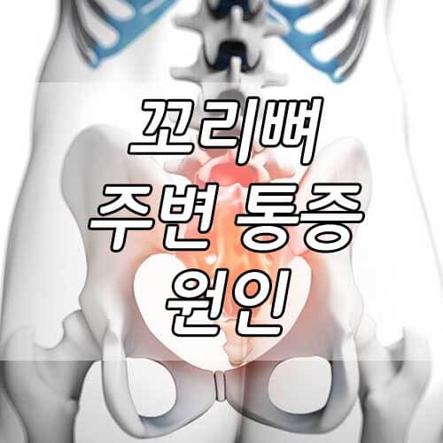 꼬리뼈 주변 통증&#44; 꼬리뼈 통증의 원인 총정리