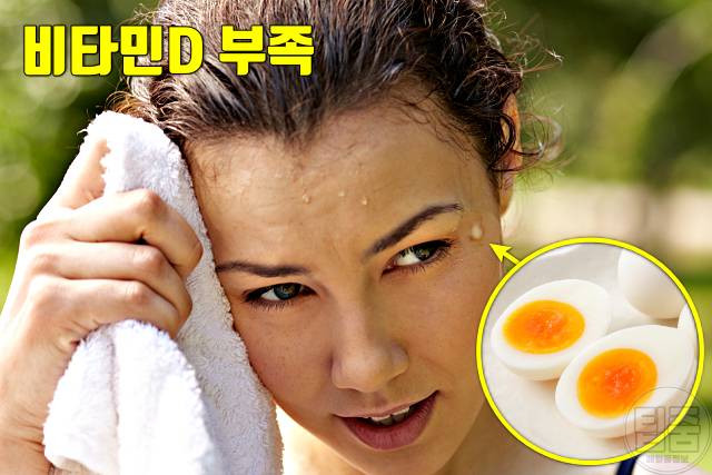 밥 잘먹는 사람 비타민d부족증상 머리 땀