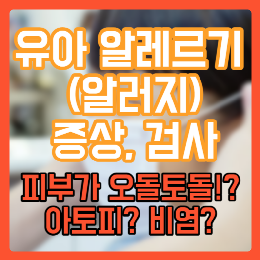 유아 알레르기 (알러지) 증상 검사