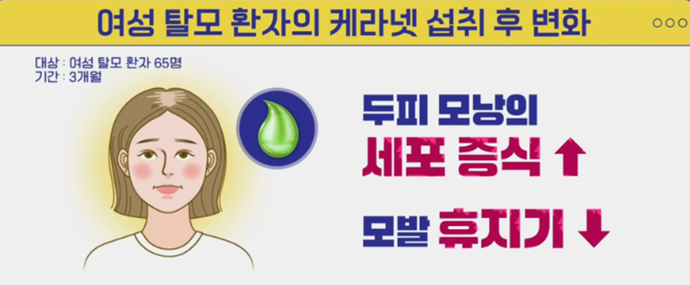 케라넷 효능