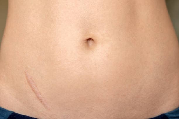 배꼽을 만지면 장기가 꼬인다는 속설의 진실