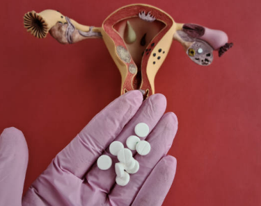 자궁근종 증상 수술후 회복기간 수술비용 좋은음식 등 총정리(최신)